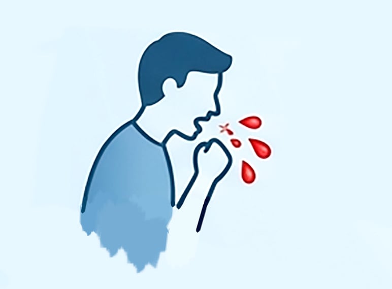কাশির সঙ্গে রক্ত গেলে করণীয়