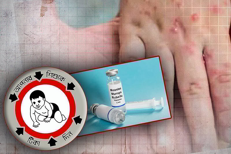 হাম কবে থেকে কমতে পারে?