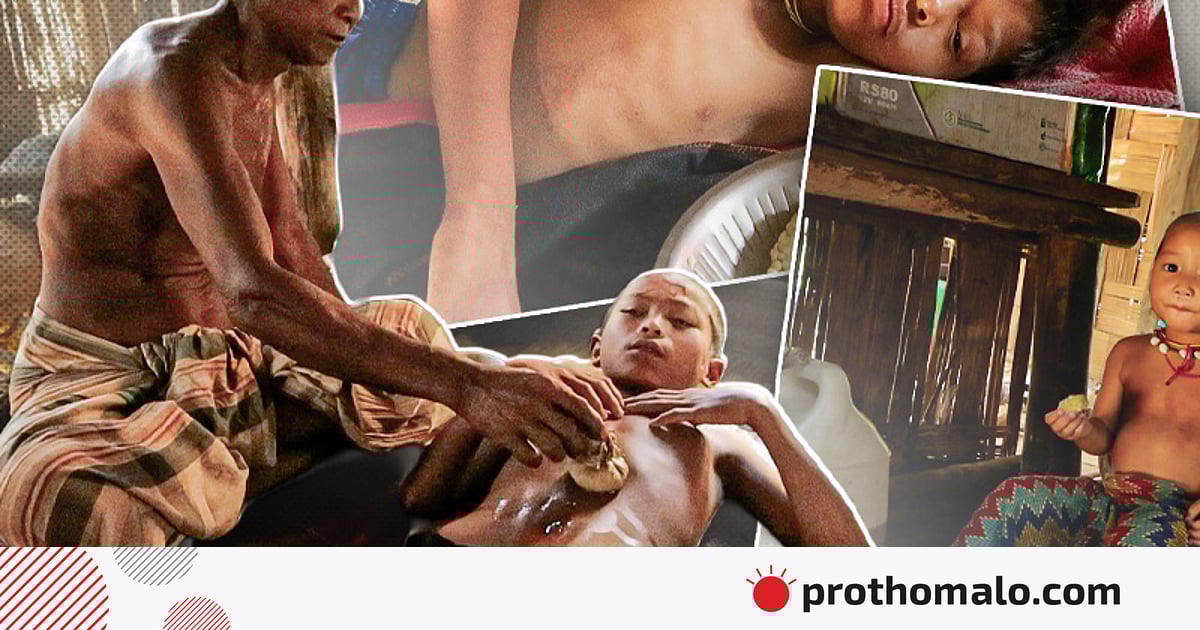 আলীকদমের দুর্গম কুরুকপাতায় হামের ভয়াবহ প্রাদুর্ভাব আলীকদমের দুর্গম কুরুকপাতায় হামের ভয়াবহ প্রাদুর্ভাব