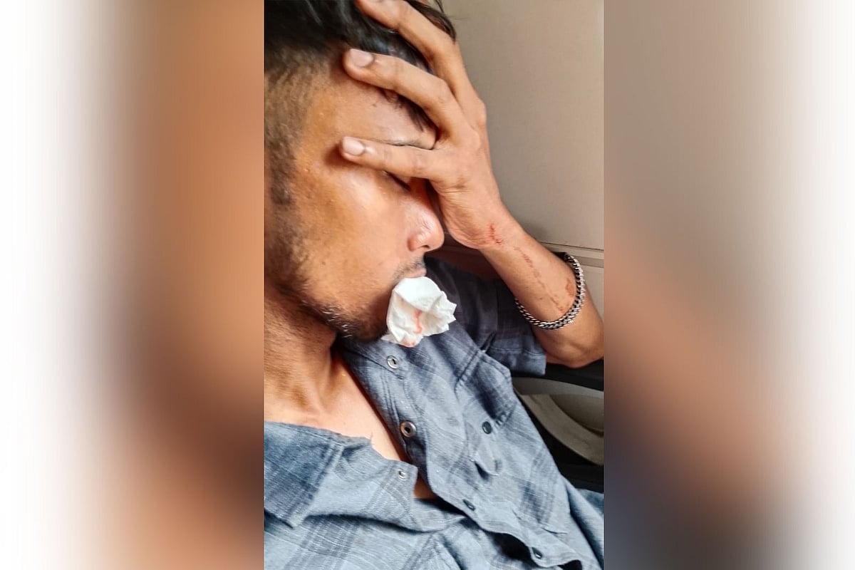 চলন্ত ট্রেনে পাথর নিক্ষেপ, ভাঙল 
কক্সবাজারফেরত যাত্রীর চার দাঁত