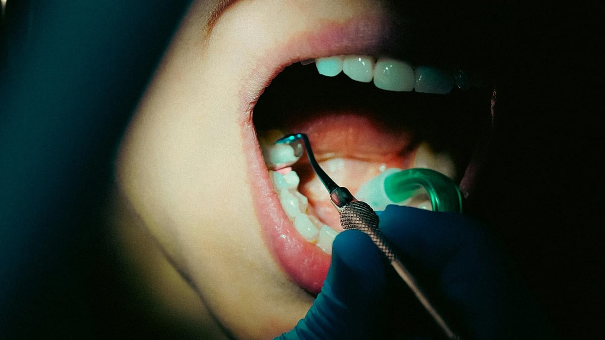 ইন্টারনেট দেখে রুট ক্যানাল করেছেন তিনি