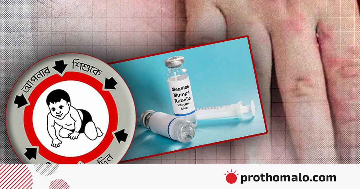 এখনো হামের টিকা দিচ্ছেন না কোনো কোনো অভিভাবক, সচেতনতা তৈরিতে কাজ করার পরামর্শ বিশেষজ্ঞের এখনো হামের টিকা দিচ্ছেন না কোনো কোনো অভিভাবক, সচেতনতা তৈরিতে কাজ করার পরামর্শ বিশেষজ্ঞের