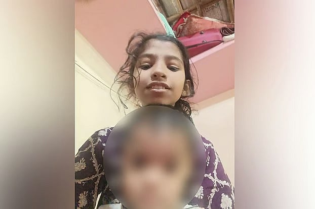 মারা গেল চোখে গুলিবিদ্ধ হওয়া সেই শিশু