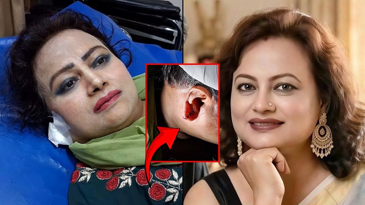 এফডিসি থেকে ফেরার পথে ছিনতাইকারীর কবলে কান ছিঁড়ে গেল নায়িকার