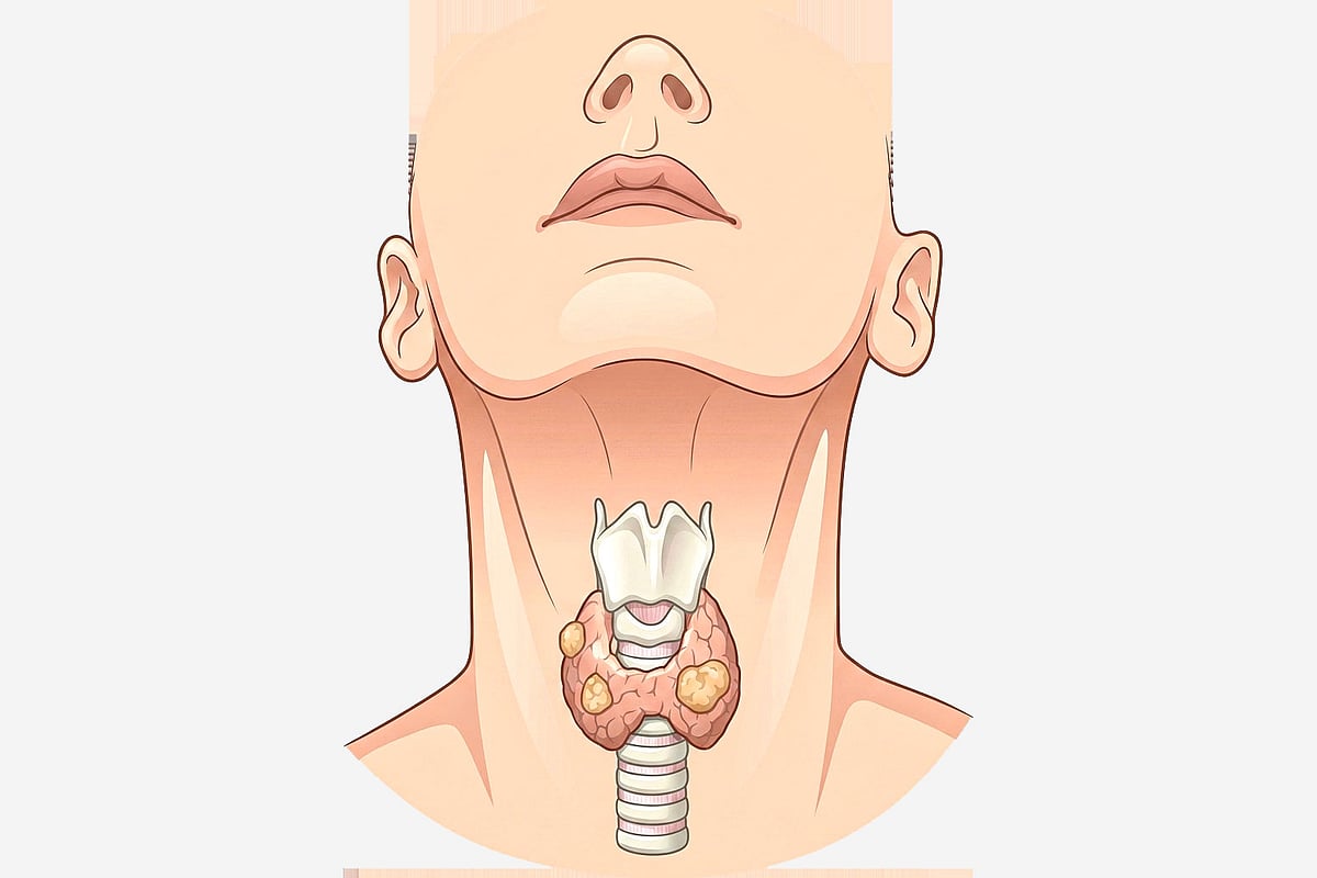 থাইরয়েড ক্যানসার কি নিরাময়যোগ্য?
