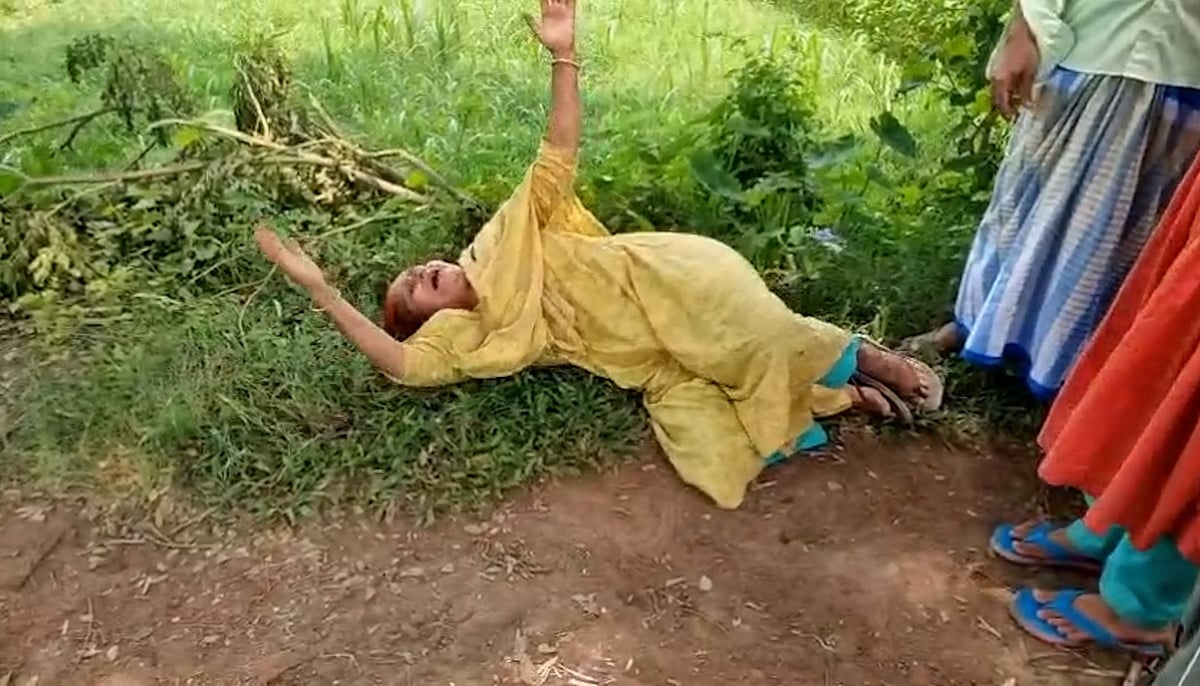 পড়ে থাকা ককটেলের বিস্ফোরণে উড়ে গেল শিশুর কবজি