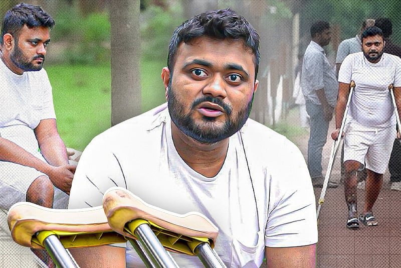 ভুল চিকিৎসায় আমার পা পচিয়ে ফেলেছিল: সড়ক দুর্ঘটনার শিকার ওমর সিদ্দিকি