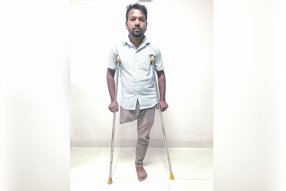 দুর্ঘটনায় হারিয়েছেন পা, এবার চুরি হলো ব্যবসার পুঁজি, দিশাহারা রিপনের পরিবার