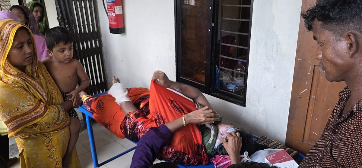 বাউফলে ফুটন্ত ভাতের হাঁড়ি ঢেলে গৃহবধূর শরীর ঝলসে দিলেন ননদ