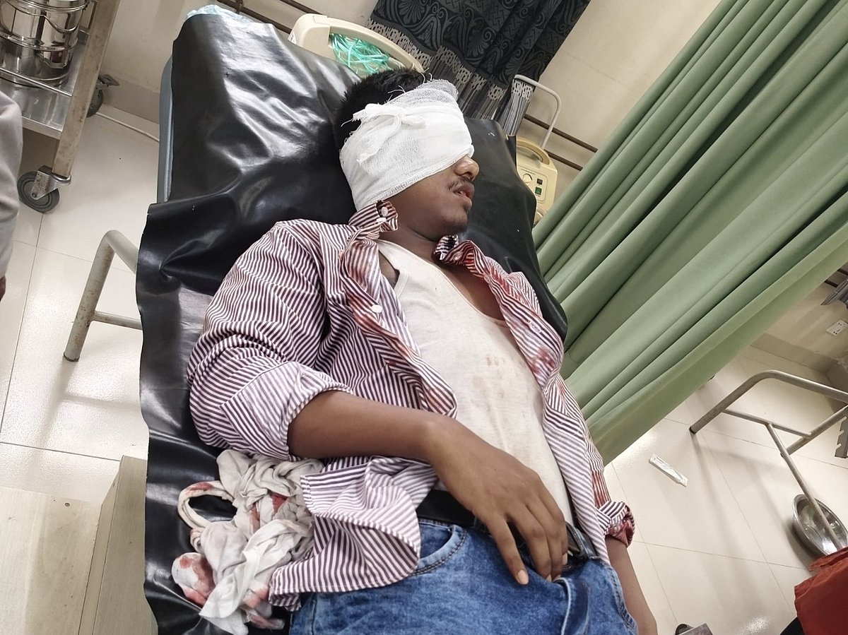 সিরাজগঞ্জে ট্রেনে পাথর নিক্ষেপ, যাত্রীর চোখে গুরুতর আঘাত