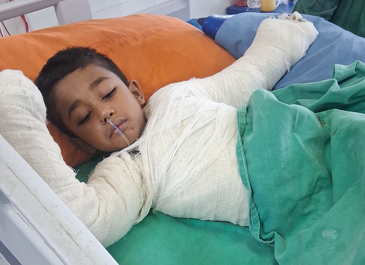 ট্রান্সফরমারের স্পার্কে হাত হারাল পাঁচ বছরের শিশু আহনাফ