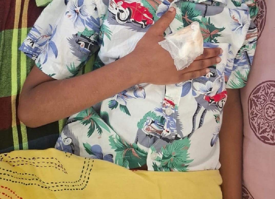 শিশুটির বিচ্ছিন্ন আঙুল জোড়া লাগেনি