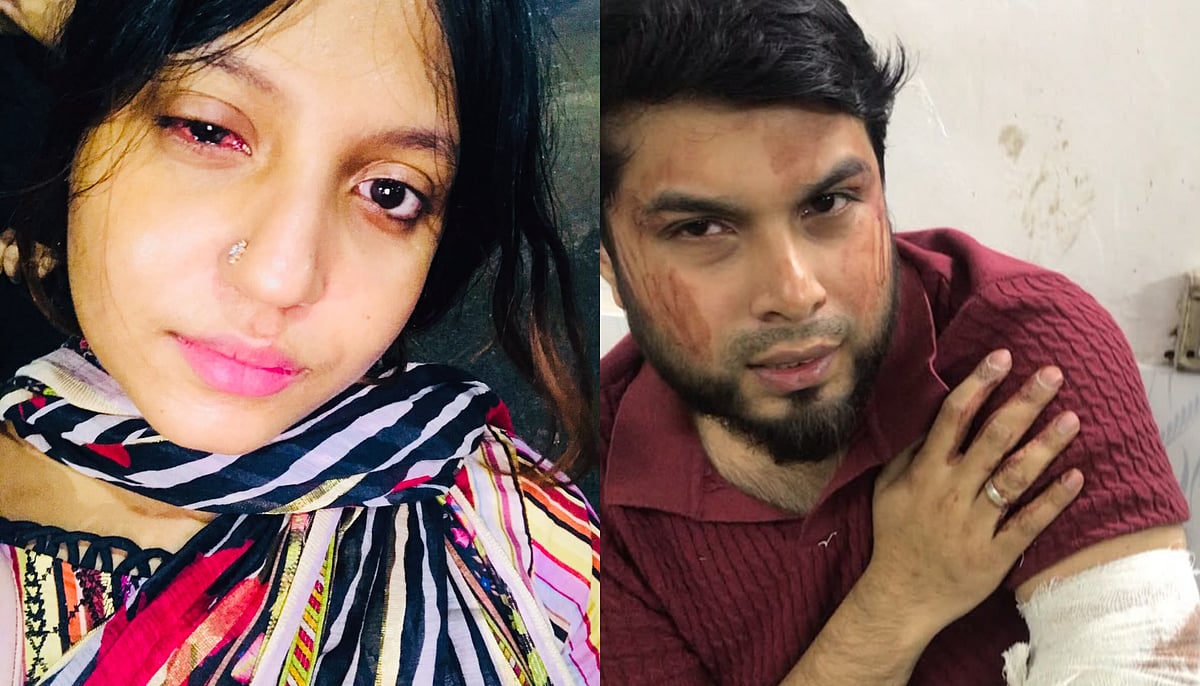বাসায় ঢুকে দম্পতিকে কুপিয়ে জখমের অভিযোগ, মামলা না নেওয়ার দাবি