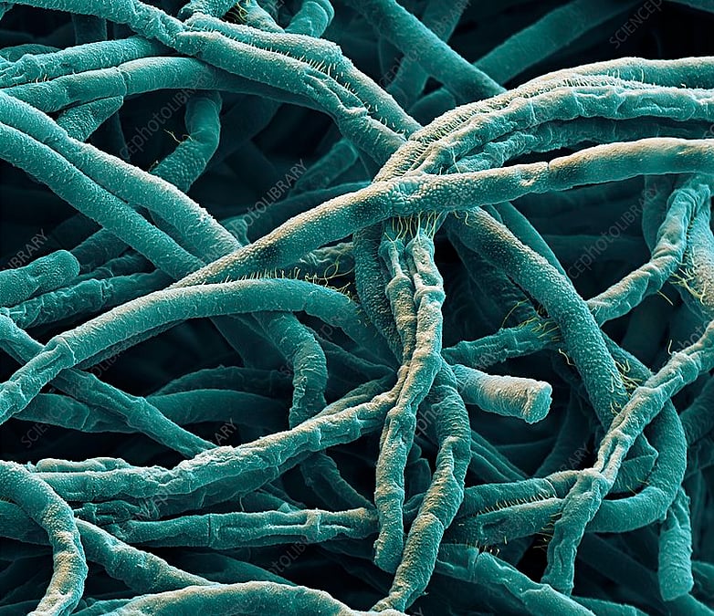 Ogirlangan shaxsiy intim fotosuratlar