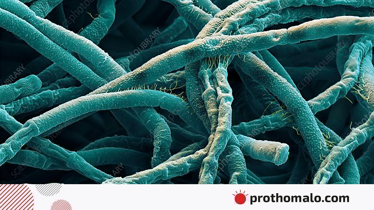 Suzish sandiqidagi yigitni silkitmoqda Dunyodagi eng pornografik modellar