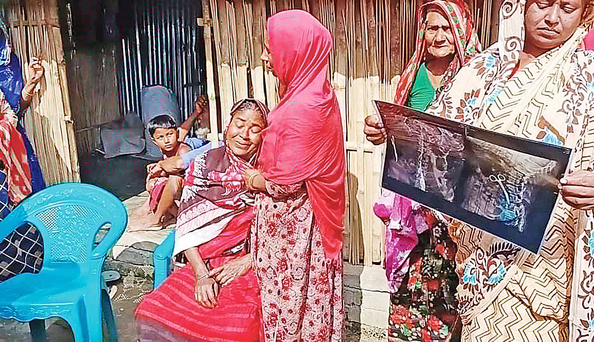 ২০০২ সালে মেহেরপুরে একটি ক্লিনিকে পেটে অস্ত্রোপচার করিয়েছিলেন বাচেনা খাতুন। পেটে ব্যথার জন্য কিছুদিন আগে এক্স–রে করালে অস্ত্রোপচারের সময় পেটে রাখা কাঁচি ধরা পড়ে। এক্স–রেতে সেই দৃশ্য দেখছেন প্রতিবেশীরা। এ সময় কান্না করেন বাচেনা। সম্প্রতি মেহেরপুরের গাংনীতে