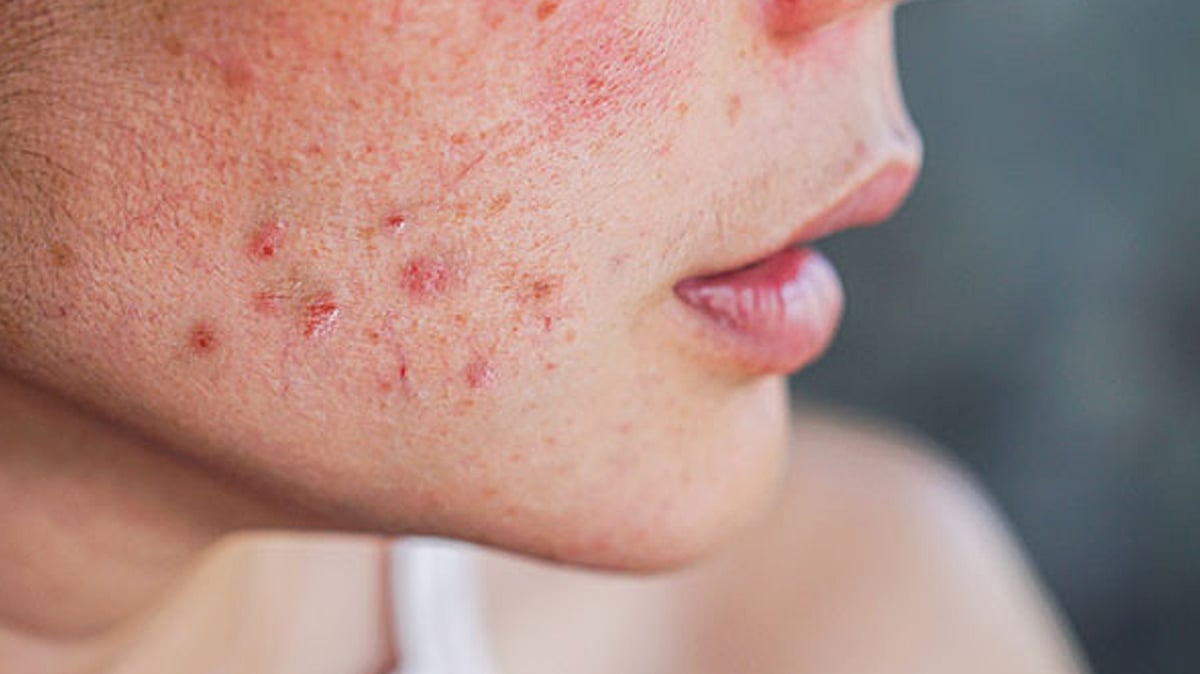 Tanlangan yalangoch videolar