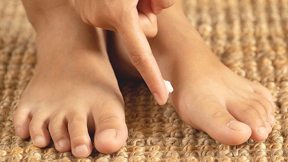 না জেনেবুঝেই দোকান বা হকারদের কাছ থেকে বিভিন্ন মলম কিনে ব্যবহার করা ঠিক নয়