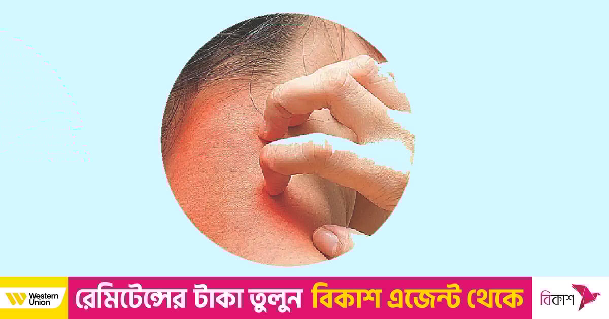 Gozallikka anal jinsiy aloqa dengizi berildi Semiz yigit bilan jinsiy aloqa