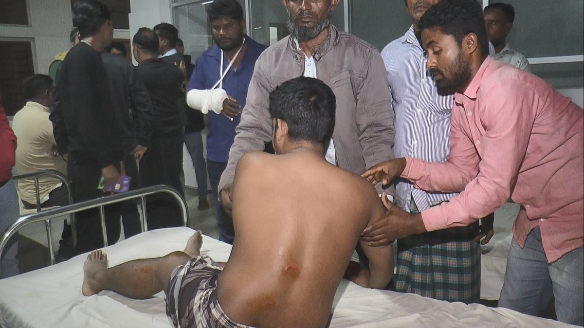 হাতুড়িপেটায় যুবকের পিঠে ক্ষতের চিহ্ন। মঙ্গলবার রাতে মাদারীপুর ২৫০ শয্যা জেলা হাসপাতালে