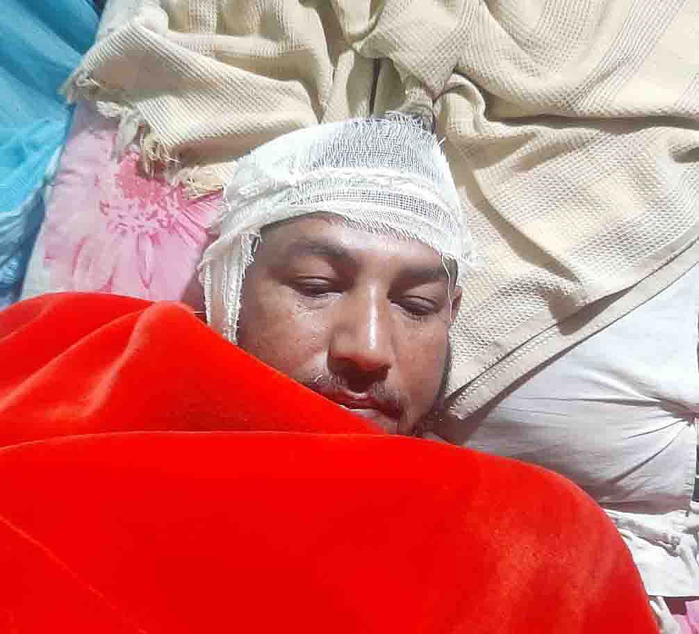 যুবলীগ নেতার মারধরে আহত নাটোরের বড়াইগ্রামের লক্ষ্মীকোল হাটের ইজারাদার যুবায়ের হোসেন। আজ সোমবার সকালে বড়াইগ্রাম উপজেলা স্বাস্থ্য কমপ্লেক্সে