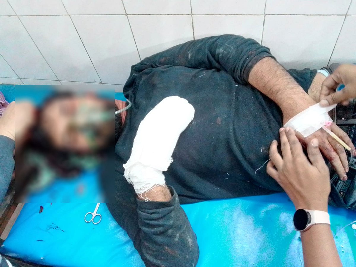 নরসিংদীর রায়পুরায় আসামি পক্ষের হামলায় আহত র্যাব সদস্য। মঙ্গলবার রাতে নরসিংদী সদর হাসপাতালে