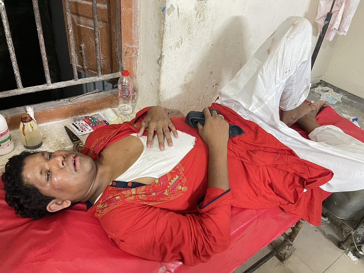 আহত আশরাফুল আলম কলাপাড়া স্বাস্থ্য কমপ্লেক্সে চিকিৎসা নিয়েছেন। গতকাল বৃহস্পতিবার রাতে তোলা