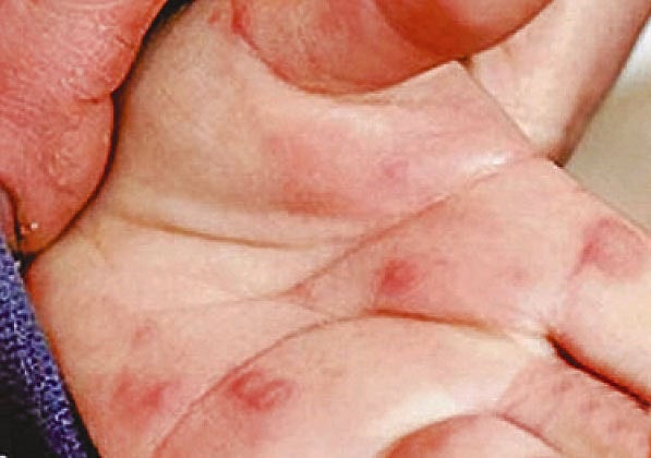 Kokraklar futbolka ostida korinadi