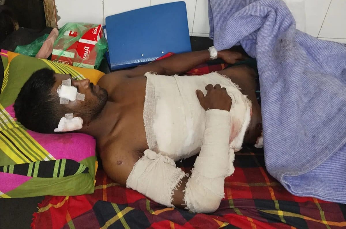 আধিপত্য বিস্তারকে কেন্দ্র করে দুই পক্ষের সংঘর্ষের সময় হাতবোমা বিস্ফোরণে গুরুতর আহত দ্বীন ইসলাম