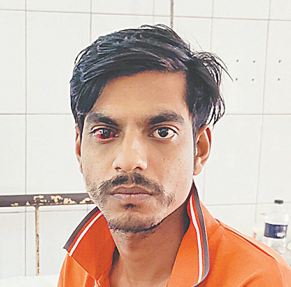 ডান চোখে ছররা গুলি লেগেছে বরিশালের নথুল্লাবাদের বাসিন্দা রাকিবুল আহসানের। গত মঙ্গলবার বিকেলে জাতীয় চক্ষুবিজ্ঞান ইনস্টিটিউট ও হাসপাতালে