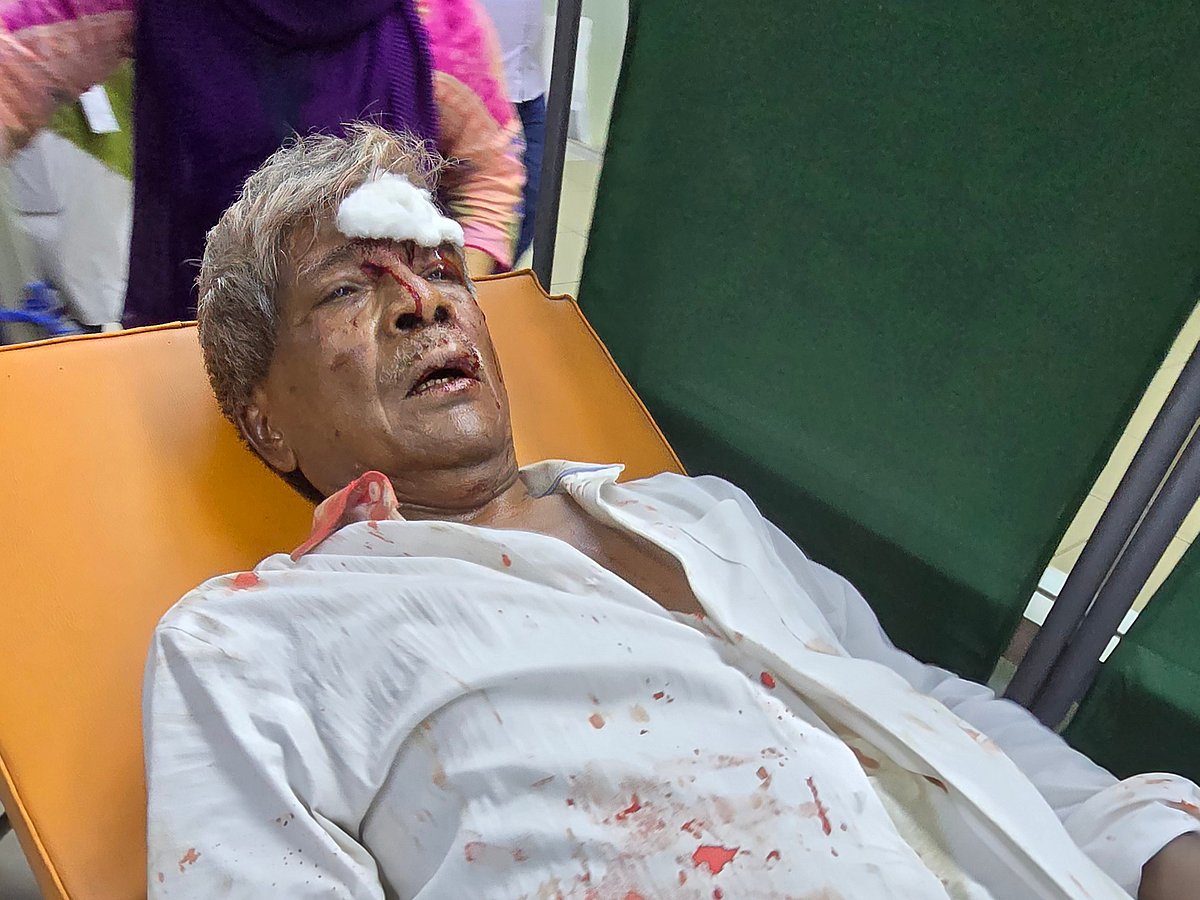 ৫ আগস্ট আওয়ামী লীগ সরকার পতনের দিন ঢাকা বিমানবন্দরের কাছে হামলার শিকার হন অধ্যাপক মো. আনোয়ার হোসেন