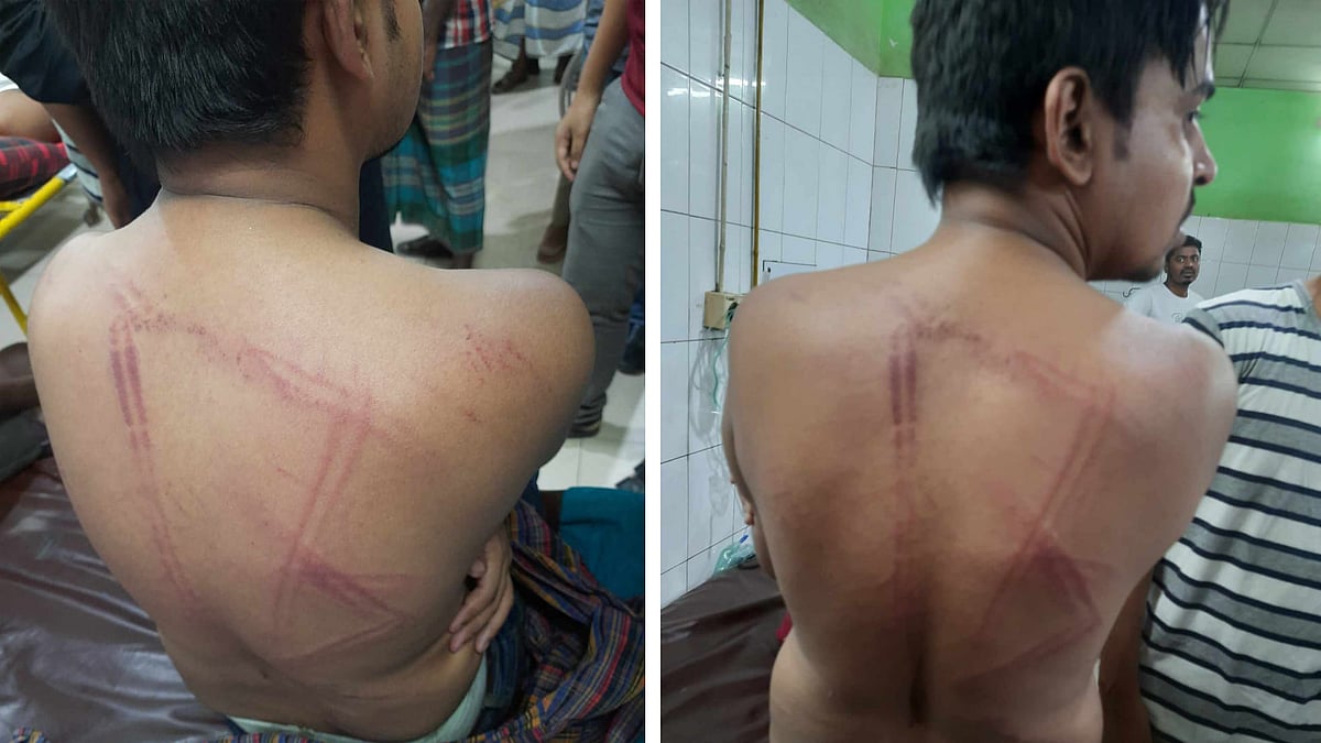 মারধরের শিকার ঢাকা বিশ্ববিদ্যালয় সাংবাদিক সমিতির সভাপতি আল সাদী ভূইয়া এবং জাগো নিউজের নিজস্ব প্রতিবেদক নাহিদ হাসান