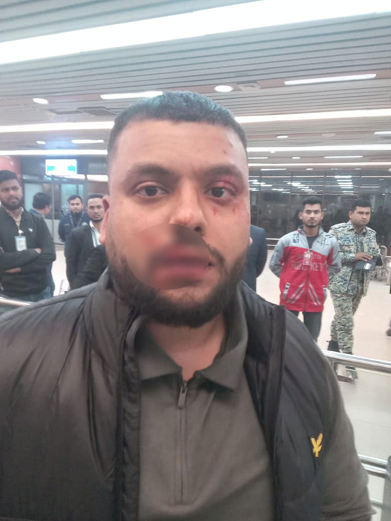 হেনস্তা ও মারধরের শিকার একজন প্রবাসী