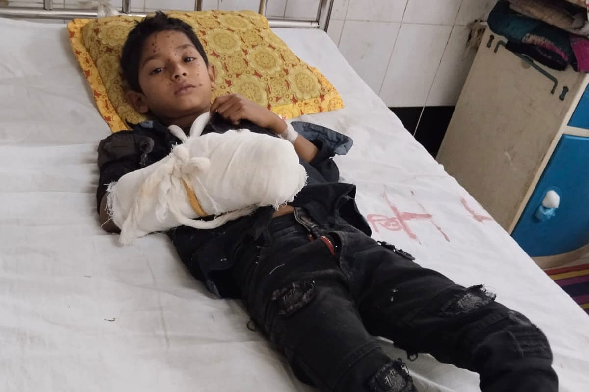 রাজধানীর শনির আখড়ায় ময়লার স্তূপে কুড়িয়ে পাওয়া সাউন্ড গ্রেনেডের বিস্ফোরণে আহত হয়েছে এই শিশু