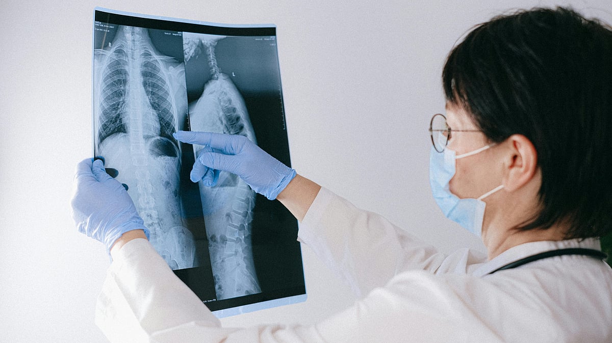 বাতরোগ যত আগে নির্ণয় করা যায়, চিকিৎসায় তত দ্রুত উন্নতি সম্ভব