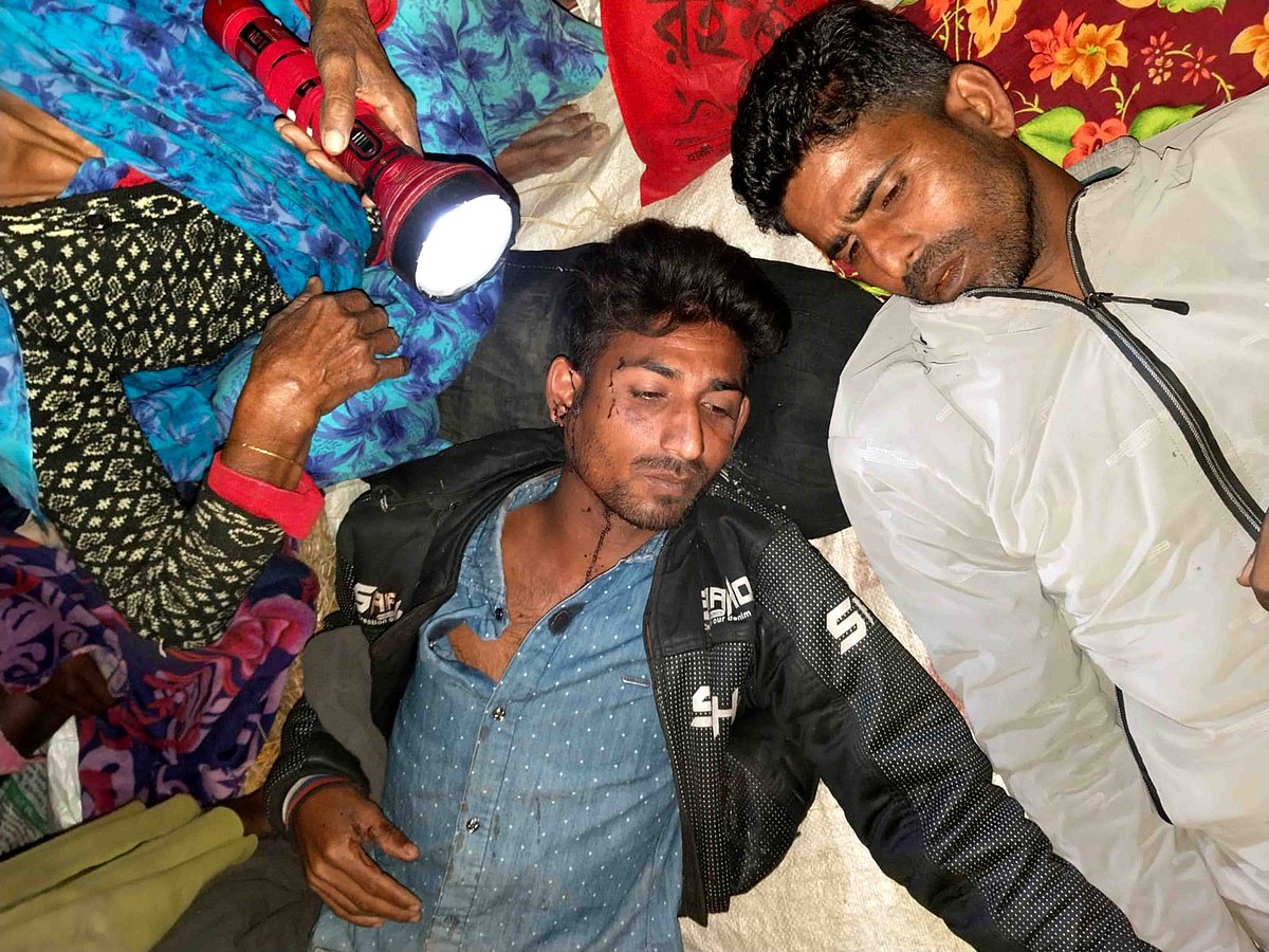 গুরুতর আহত ব্যক্তিদের নাটোর সদর হাসপাতালে ভর্তি করা হয়েছে। গতকাল শনিবার রাতে