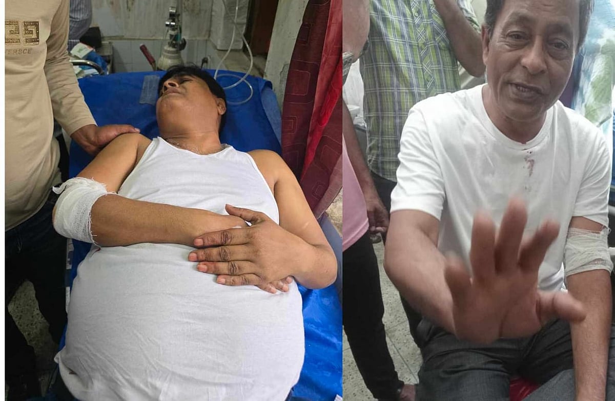 পটুয়াখালী বিজ্ঞান ও প্রযুক্তি বিশ্ববিদ্যালয়ের ক্যাম্পাসে বিএনপির দুই পক্ষের সংঘর্ষে আহত দুমকি
উপজেলা বিএনপির সাংগঠনিক সম্পাদক ইব্রাহিম থলিল ও সদস্য মতিউর রহমান