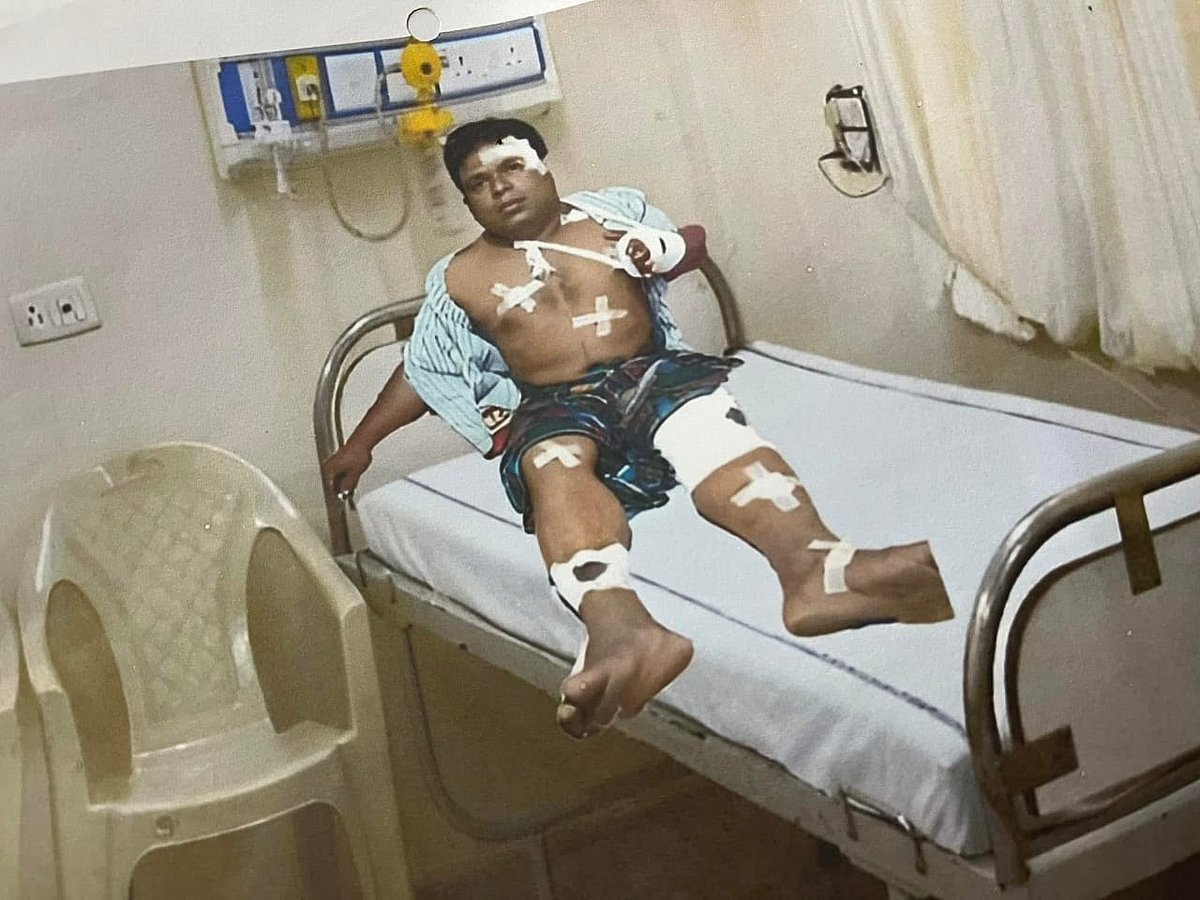 নিজেকে আহত দেখানোর জন্য ছবি ফটোশপ করেছেন নয়ন সিকদার