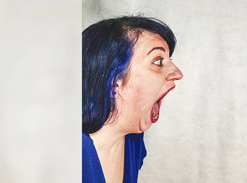 মারি পার্ল জালমার রবিনসন একটি বড় কমলা বা আস্ত টেনিস বল অনায়াসে মুখে পুরে দিতে পারেন