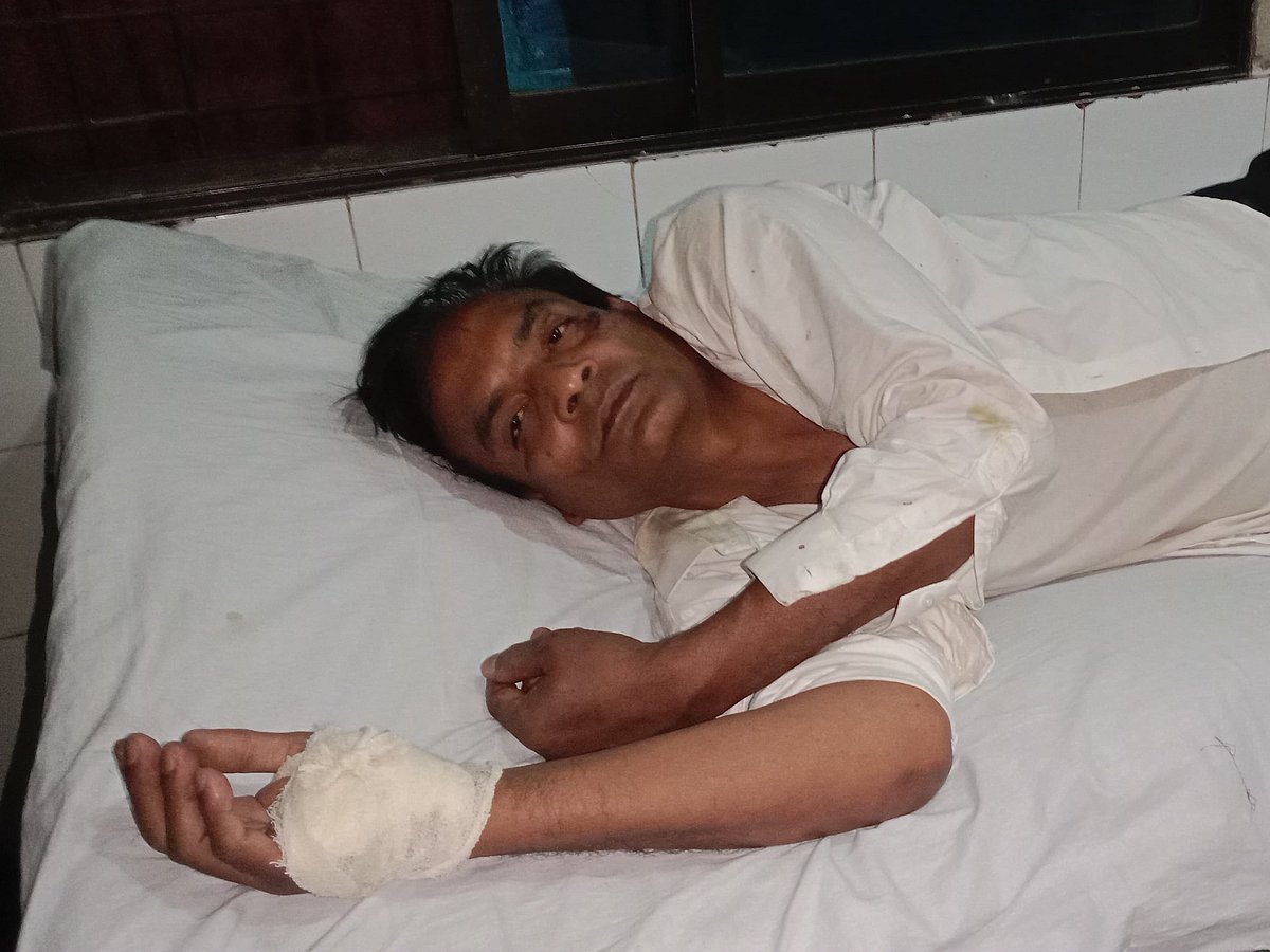 দিনাজপুরের কাহারোল উপজেলায় মারধরের শিকার হয়ে হাসপাতালে চিকিৎসা নিচ্ছেন সুন্দরপুরের ইউপি চেয়ারম্যান আনোয়ার হোসেন। বৃহস্পতিবার দুপুরে দিনাজপুর মেডিকেল কলেজ হাসপাতালে