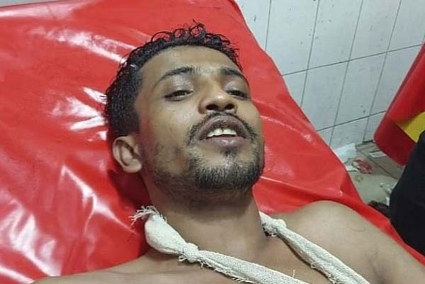 গুলিবিদ্ধ রুবেল হোসেন