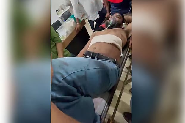 রাজধানীর মিরপুর-১–এর গোলাগুলির ঘটনায় আহত সাজ্জাদ হোসেনকে ঢাকা মেডিকেল কলেজ হাসপাতালে ভর্তি করা হয়