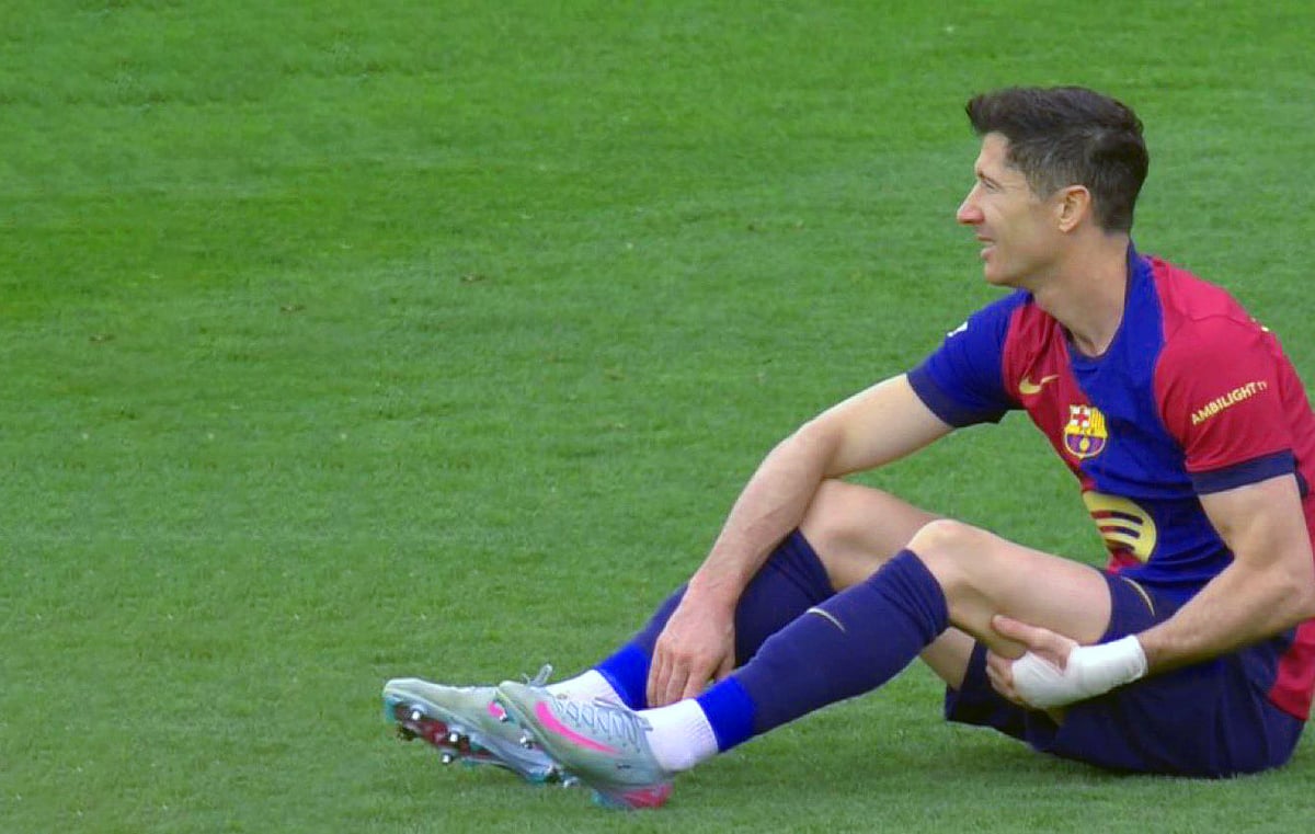 চোট পেয়েছেন রবার্ট লেভানডফস্কি