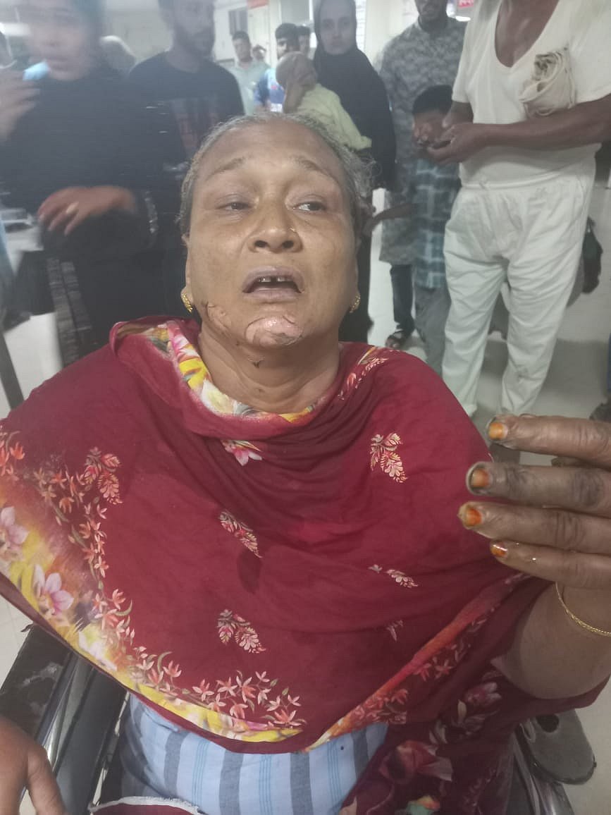 দগ্ধ লায়লা বেগম