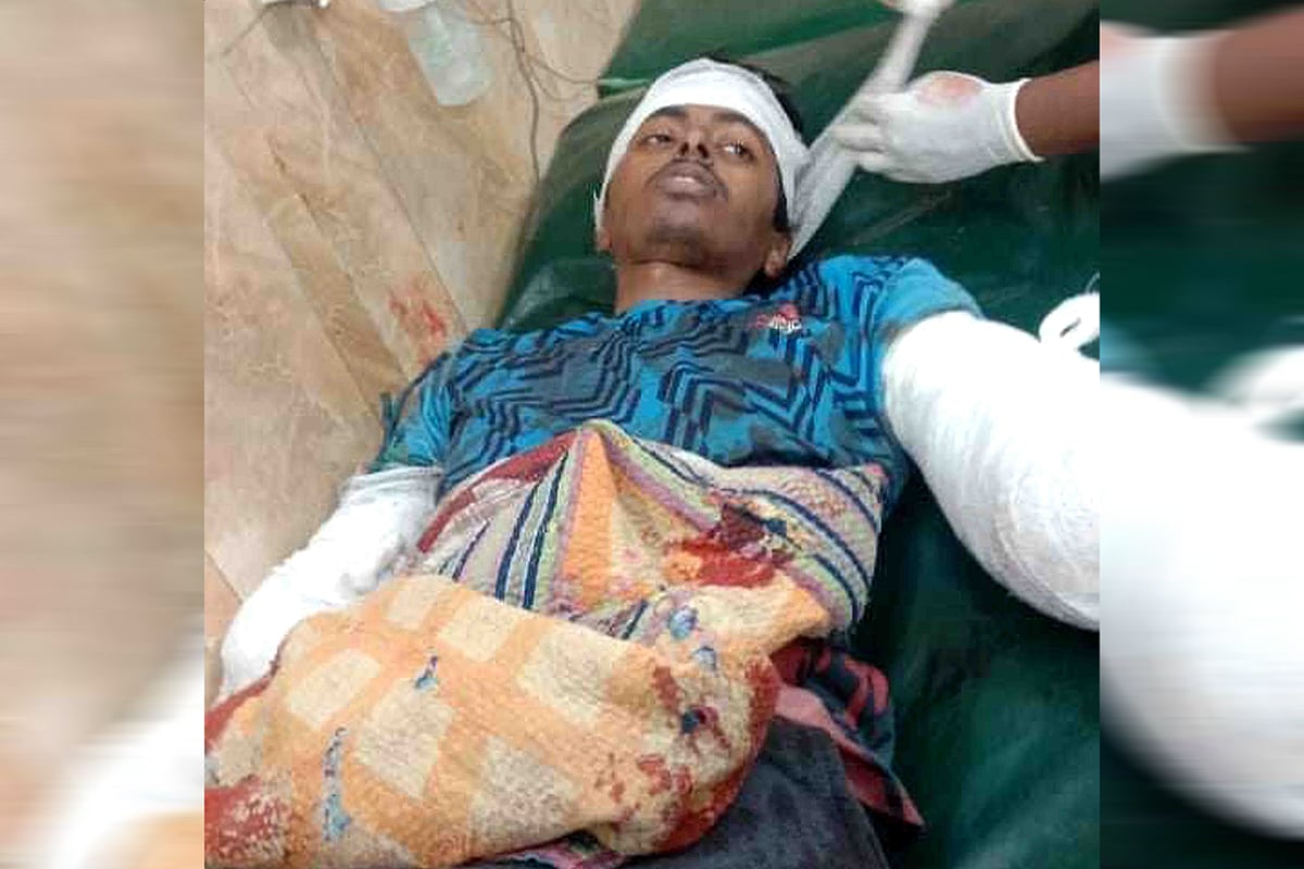 নাটোরে দুই হাতের কবজি কেটে ফেলার পর ইস্রাফিল হোসেনকে বৃহস্পতিবার সকালে নাটোর সদর হাসপাতালে নিয়ে আসা হয়