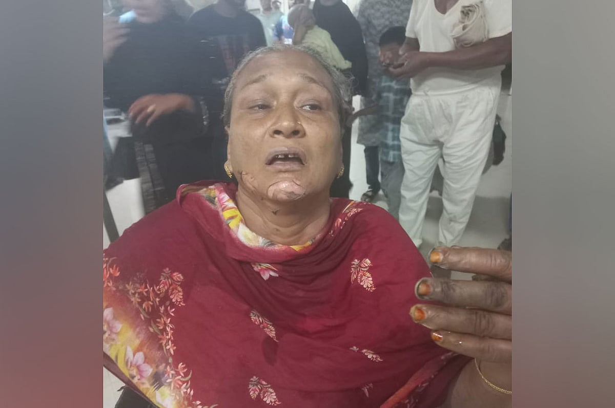 অটোরিকশায় ছোঁড়া পেট্রলবোমায় দগ্ধ লায়লা বেগম