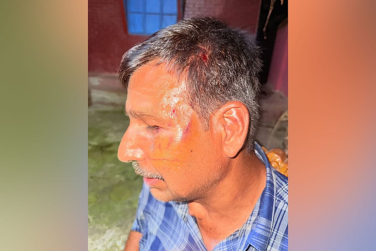 রাউজানে উপজেলা ছাত্রদলের সাবেক যুগ্ম সম্পাদক মুরাদুল আলমের হামলায় আহত হয়েছেন বলে অভিযোগ করেন তাঁর চাচা মুহাম্মদ এসকান্দর