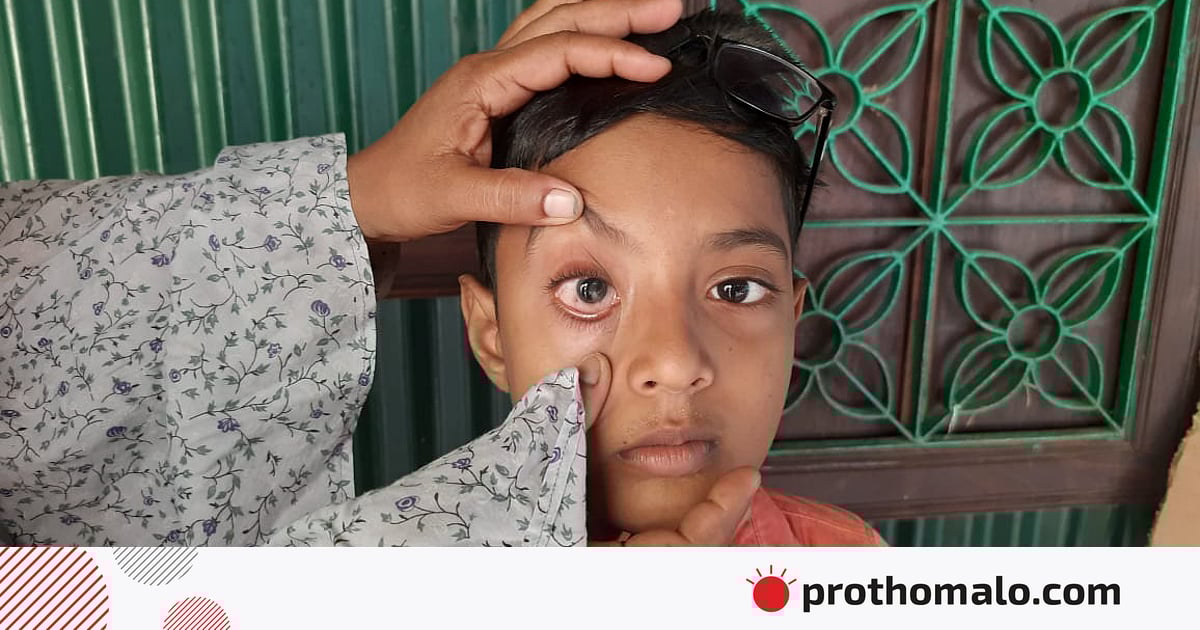 Гимнасттар спорттық құрал-жабдықта есектің ішіне кіріп кетеді Гимнасттар спорттық құрал-жабдықта есектің ішіне кіріп кетеді