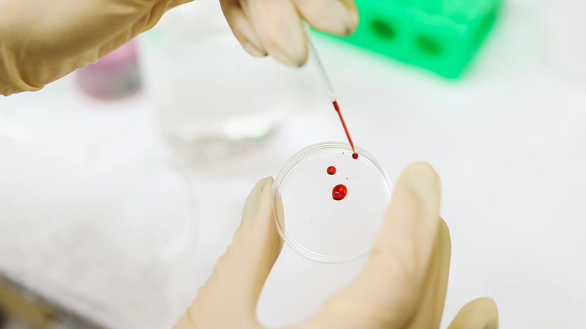 থ্যালাসেমিয়া রক্তের এমন একটি রোগ, যা ক্রোমোজোমের মাধ্যমে বংশানুক্রমে পরিবাহিত হয়