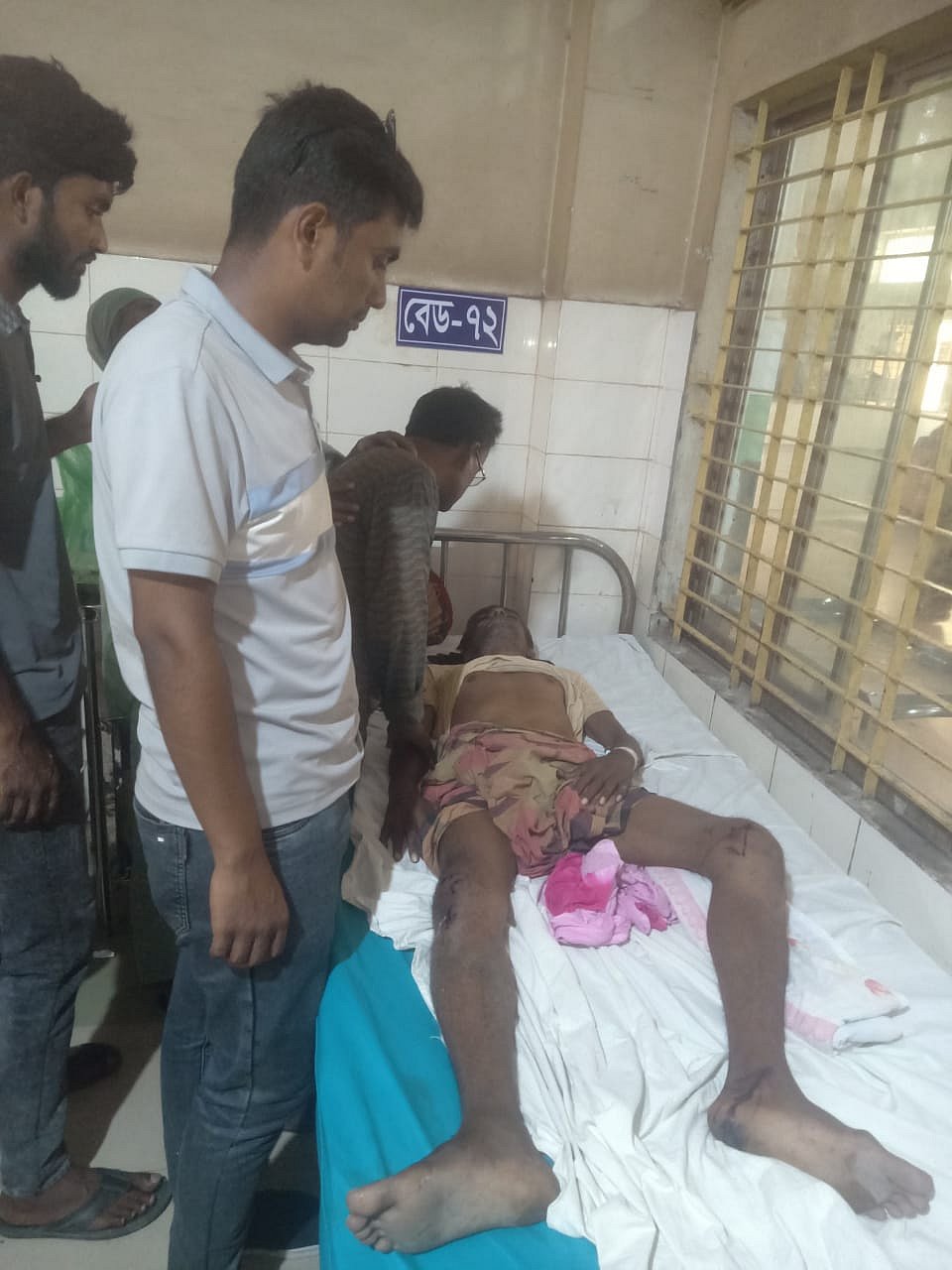 আহত বিএনপির কর্মীকে রাজশাহী মেডিকেল কলেজ হাসপাতালে ভর্তি করা হয়েছে। বৃহস্পতিবার বিকেলে